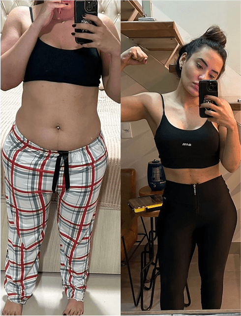 Antes e depois de cliente que usa Tizerpatida