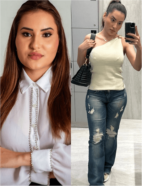 Antes e depois de cliente que usa Tizerpatida