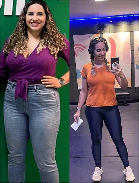 Antes e depois de cliente que usa Tizerpatida